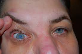 Színes kontaktlencsék, amelyek szemét nagyítják